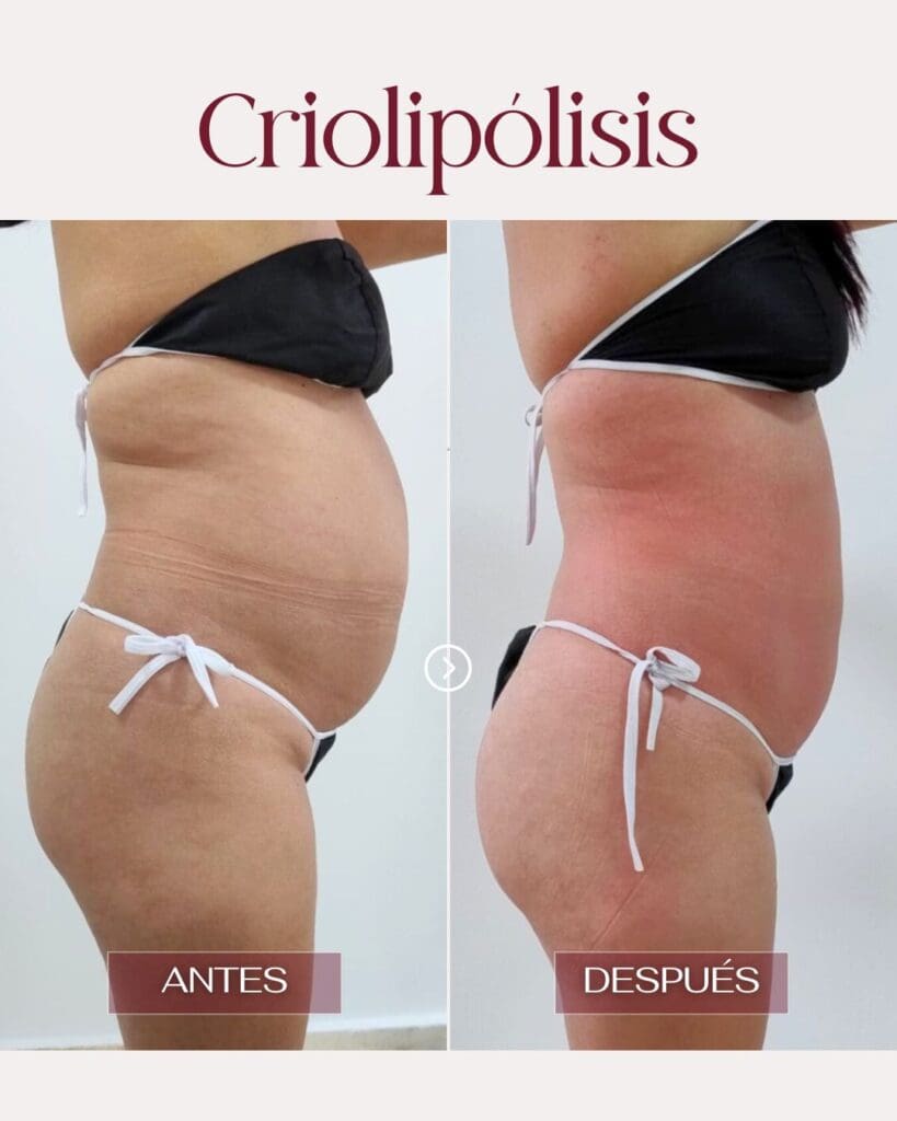 RESULTADOS CORPORALES